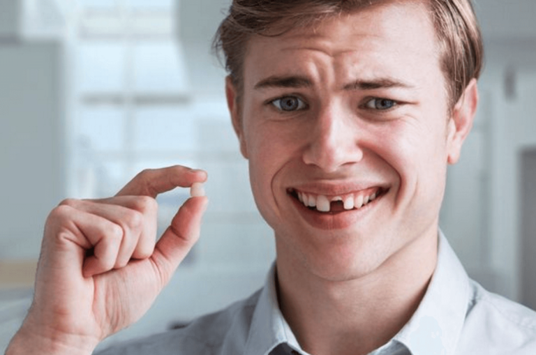 Nằm mơ thấy rụng răng có điềm báo gì? Nên đánh lô đề số gì dễ trúng